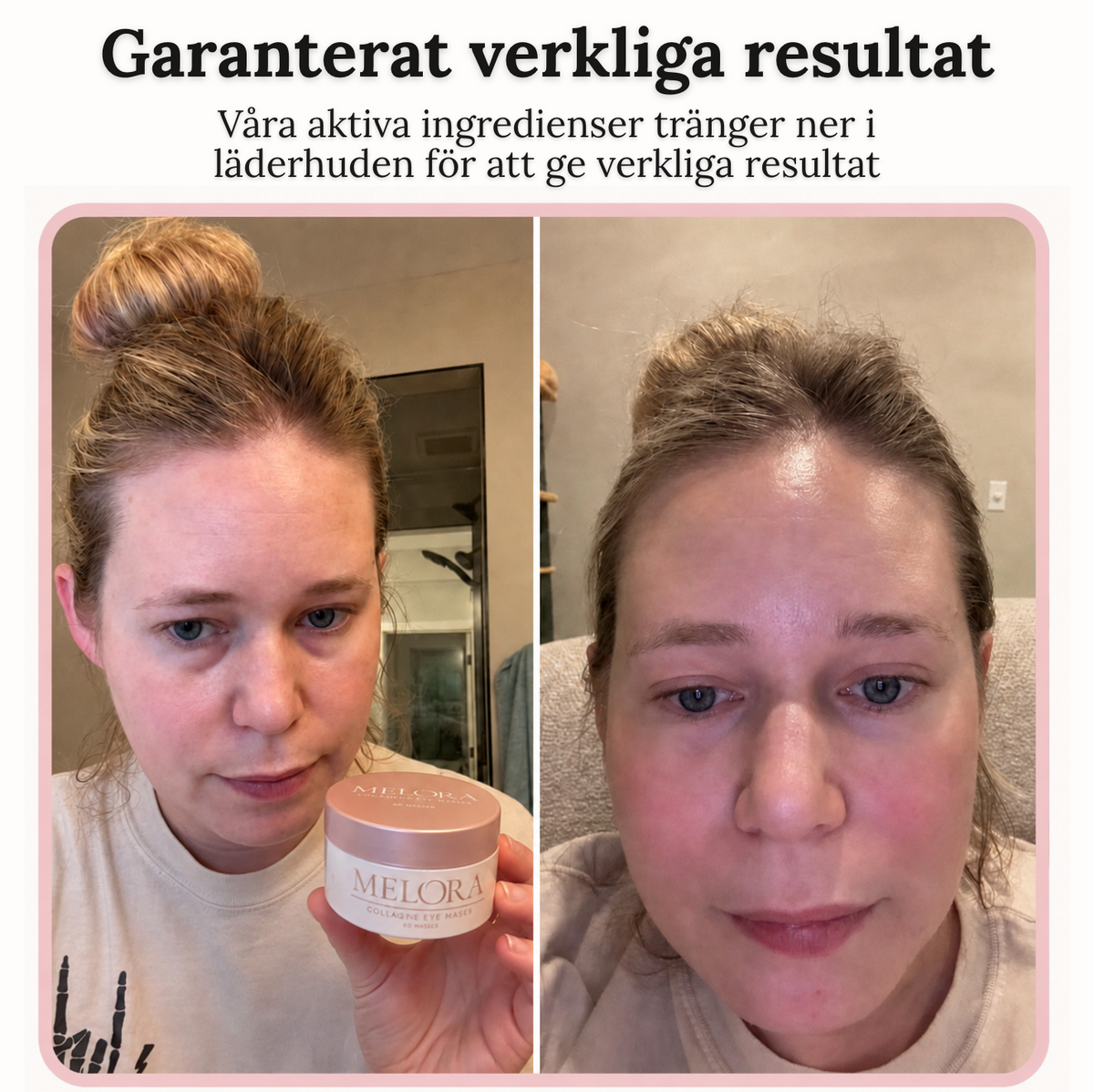 Kollageeniset silmänaamiot, 60 kpl
